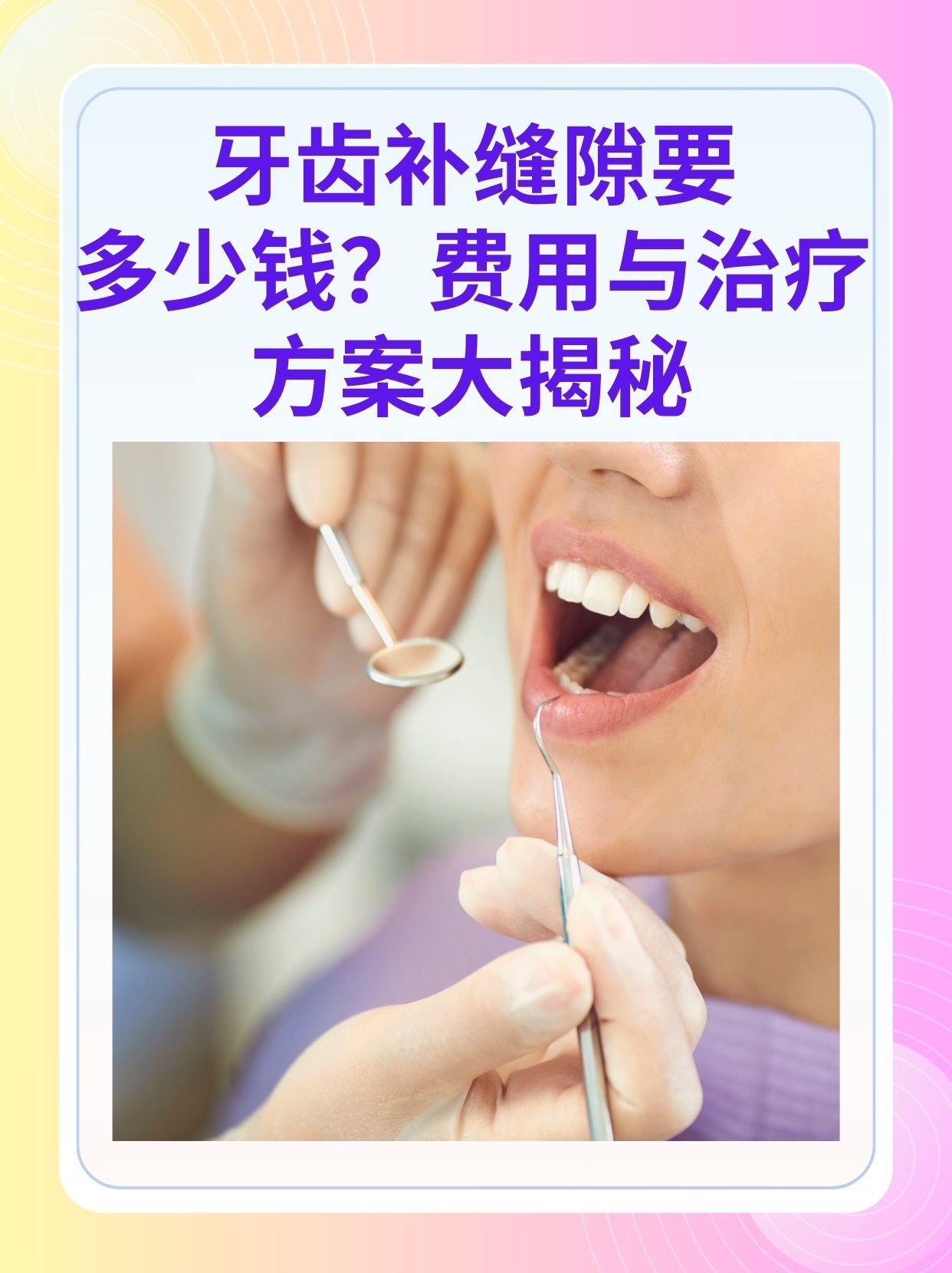 鞍山补牙医保可以报销吗(补牙医保可以报销吗 哪些可以报销呢)